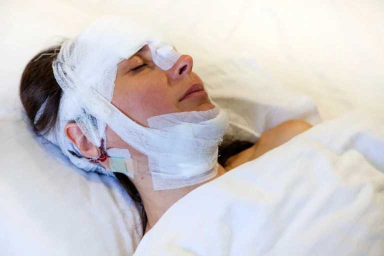Patient lying in bed with head and face wrapped in white medical bandages.